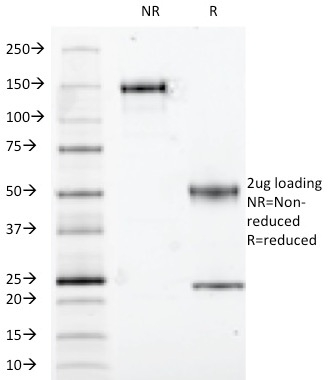 Data from SDS-PAGE analysis of Anti-S100B antibody (Clone S100B/1012). Reducing lane (R) shows heavy and light chain fragments. NR lane shows intact antibody with expected MW of approximately 150 kDa. The data are consistent with a high purity, intact mAb.